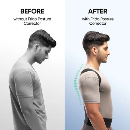 Posture Corrector Belt For Men And Women